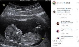 网友爆料医院b超室视频,网友曝光真实工作场景