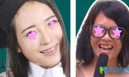 广州雅度口腔爆料事件最新,揭露行业乱象，患者权益引关注